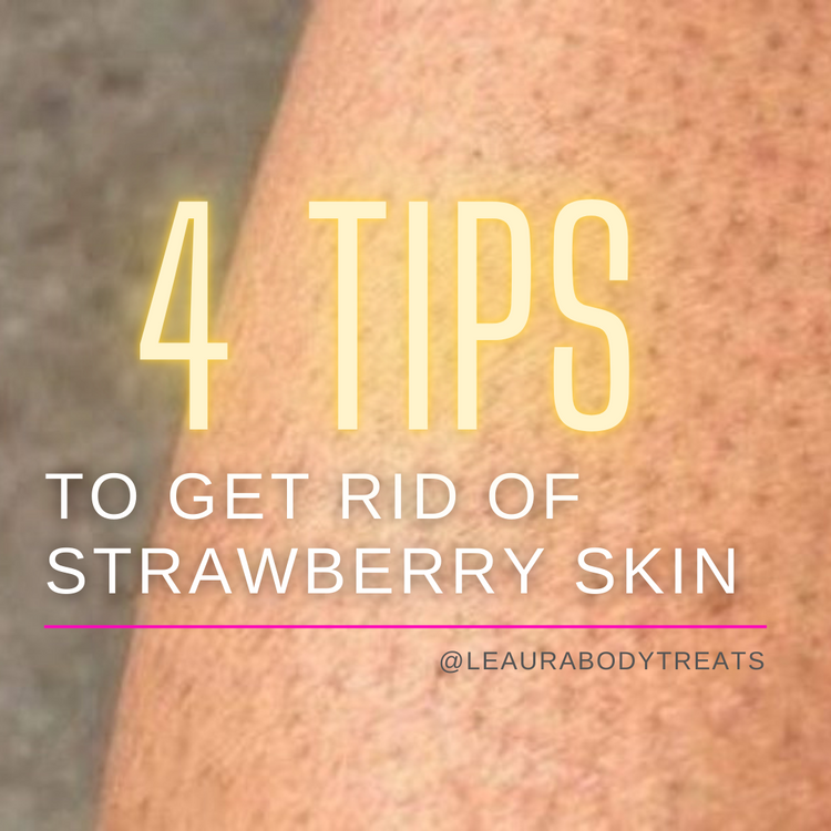 Strawberry Rashes How to get rid of strawberry skin (4 tips for preventive care) – Leaura ...